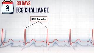 Day 3: QRS complex In Action | 30-Day ECG Challenge