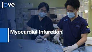 Myocardial Infarction Elevation with Lactate Blood: Cardioprotection | Protocol Preview
