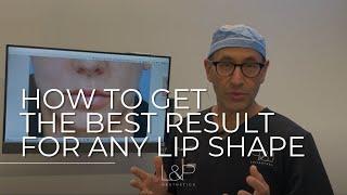 Lip Lift, Corner Lip Lift - Bay Area Plastic Surgeon - How To Get The Best Result For Any Lip Shape