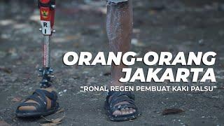 Kisah Ronald Regen, Sang Pembuat Kaki Palsu