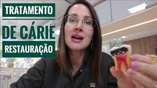 TRATAMENTO DE CÁRIE - RESTAURAÇÃO - DRA DANIELLE SALES