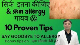 10 Tips for Skin allergy treatment at home| स्किन एलर्जी को जल्दी ठीक करने की १० टिप्स Dermatologist