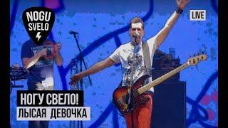 Ногу Свело! - Лысая девочка (Live)