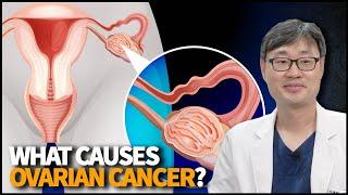 What Causes Ovarian Cancer? How to Detect it Early and How to Treat it