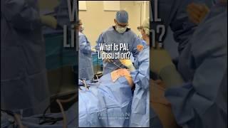 What Is PAL Liposuction?