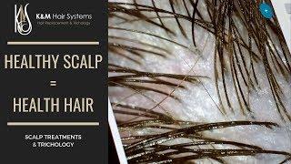 HEALTHY SCALP = HEALTHY HAIR - TRICHOLOGY