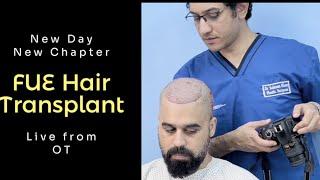 Here’s a new Chapter from FUE Dairy I FUE Hair Transplant Live from OT I #drsalman #fue #haircare