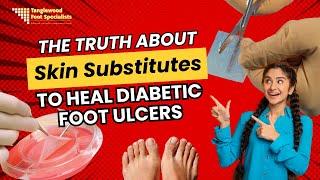 The Truth About Skin Substitutes for Diabetic Foot Ulcers