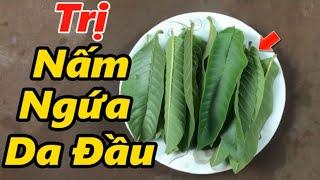 Cách trị bệnh nấm da đầu bằng lá ổi an toàn hiệu quả, sạch nấm, sạch gàu, kích thích tóc mọc nhanh