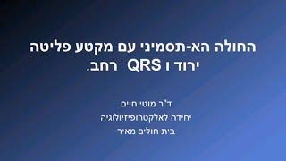 החולה הא-תסמיני עם מקטע פליטה ירוד ו QRS רחב , דר' מ. חיים