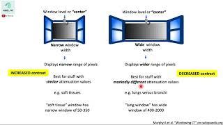 Window width and window level (CT) - simplified