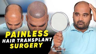 Hair Transplant in Jodhpur | Best Results & Cost of Hair Transplant in Jodhpur