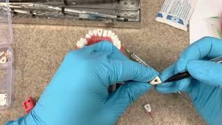 How to pass the CDCA ADEX Dental Exam Part 2 Endo