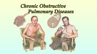 COPD (Anatomy -Pathophysiology-History-Physical Sign -Investigation-Management)