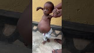 Ethan needs a someone to help him get treatment. He is also in Pain. #baby #shorts