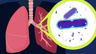 What is NTM Lung Disease?