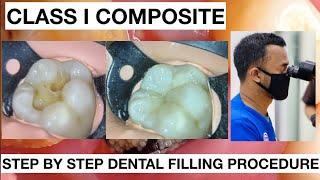 Step by Step Dental Filling Procedure | General Dentist Griya RR