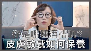 酒糟性肌膚、敏感性肌膚該如何選擇保養品？該如何治療？這集跟大家分享如何避免酒糟肌再次復發！