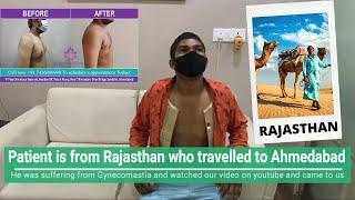 GYNECOMASTIA PATIENT FROM RAJASTHAN CAME FOR TREATMENT AT AHMEDABAD, GUJARAT FOR DR ARTH SHAH