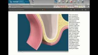 CHAIRSIDE Patient Education - Presentation Mode