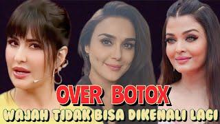 KELEBIHAN BOTOX, WAJAH 7 ARTIS INDIA INI BERUBAH LAIN