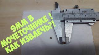 #мочекаменная болезнь, операция, стент, застрял 9 мм в мочеточнике