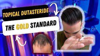 Topical Dutasteride IS THE NEW Gold Standard For Hair Loss