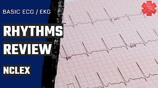 NCLEX EKG: What You Should Know