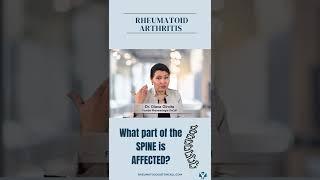 How rheumatoid arthritis affects your neck? #rheumatoidarthritis