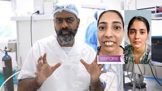 What is Jaw Surgery in Hindi | Safest Procedure to change your looks | Dr. Sunil Richardson