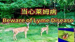 当心莱姆病 Beware of Lyme Disease  医疗保健百宝箱 (21) Healthcare Treasure Box (21)