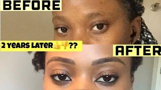 THE TRUTH ABOUT MICROBLADING | TWO YEARS LATER