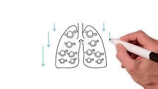 Everything you need to know about the ventilation perfusion ratio