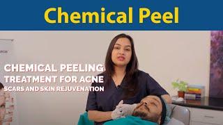 Chemical Peeling Treatment for Acne Scars and Skin rejuvenation |  | Dr.Jyoti Gupta MD