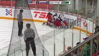 Robert Mastrosimone 1G vs Russia | Aug 8 2018 | 2018 Hlinka Gretzky