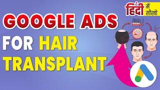 How To Run Google Ads Campaign For Hair Transplant | Google Ads For Hair Transplant