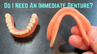 Do I always make an immediate denture ?