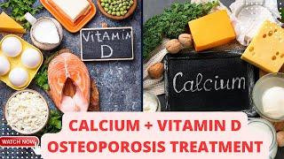 Calcium and Vitamin D: The Foundation of Osteoporosis Treatment | Christiansen Felix