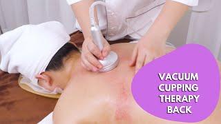 Lymphatic Drainage Massage/Back Massage| Vacuum Cupping Therapy | Part 1 myChway MS2183