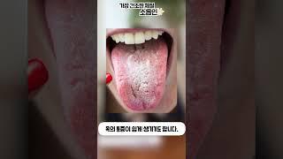 소음인은 가장 건조한 체질