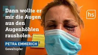 12.000 Gewalttaten im Jahr: Damit haben Opfer danach zu kämpfen | hessenschau Doku