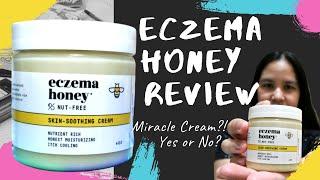 Eczema Honey Review | Baby Eczema Treatment Cream