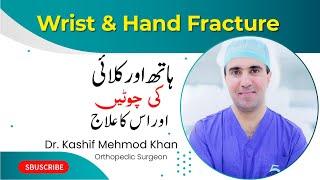 Hand and Wrist Fracture Treatment | Dr kashif Mehmood khan