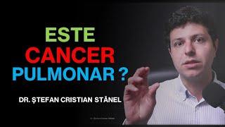 Oare este cancer la plămâni? (semne, simptome)