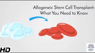 Allogeneic Stem Cell Transplant: What You Need to Know
