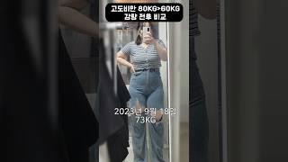 Before and after losing 20kg of high obesity in Koreans /  Face change Eye body change