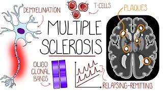 Understanding Multiple Sclerosis (Multiple Sclerosis Explained)