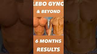 LEBO GYNO & BEYOND: 6 MONTHS POST-OP RESULTS