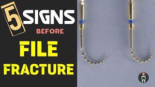 5 SIGNS before FILE FRACTURE