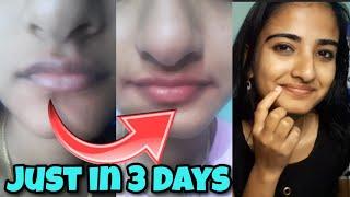 How i rid of pigmented lips| Lip care routine |Aleena's Diaries